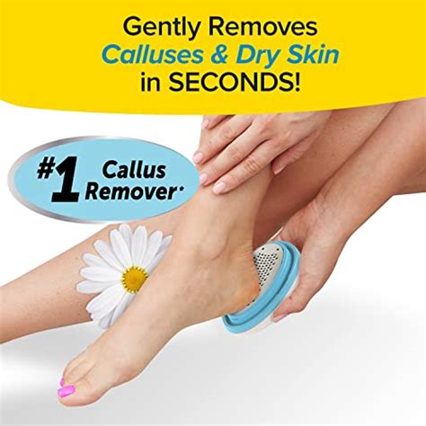 Say farewell to calluses with the help of Witchcraft callus eliminator